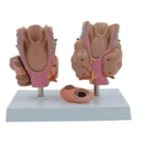 甲狀腺病理模型